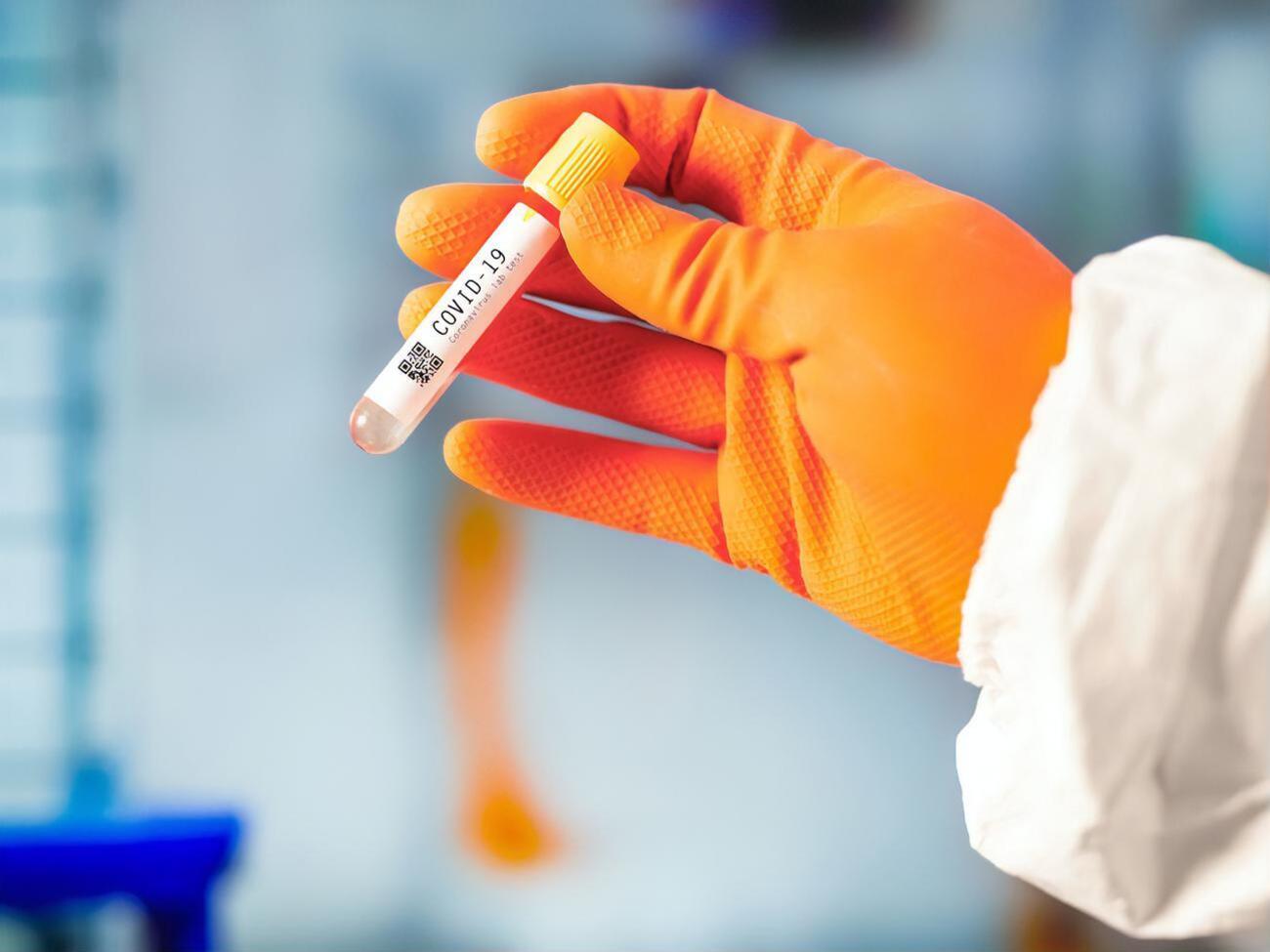 Вспышка коронавирусной инфекции COVID-19 началась в конце 2019 года в Китае