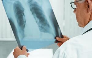 Туберкулез чаще всего поражает легкие человека