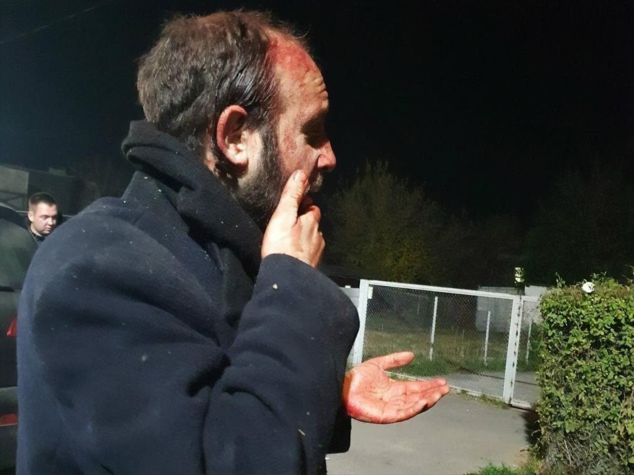 У єврейській громаді розповіли, що потерпілий має право жити в Україні