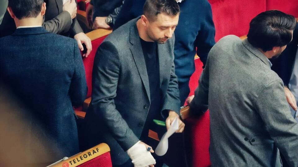 Перелом Арахамія дістав через падіння з баггі