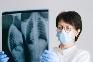 У Німеччині зростає кількість інфікованих коронавірусом