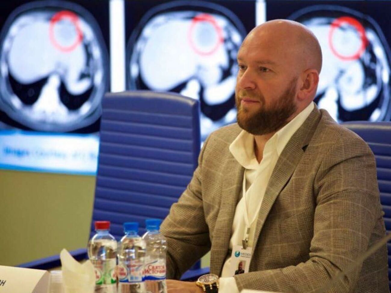 У лікарів незабаром має з'явитися два ефективні препарати, застосування яких у перші дні COVID-19 запобігає тяжкому перебігу хвороби