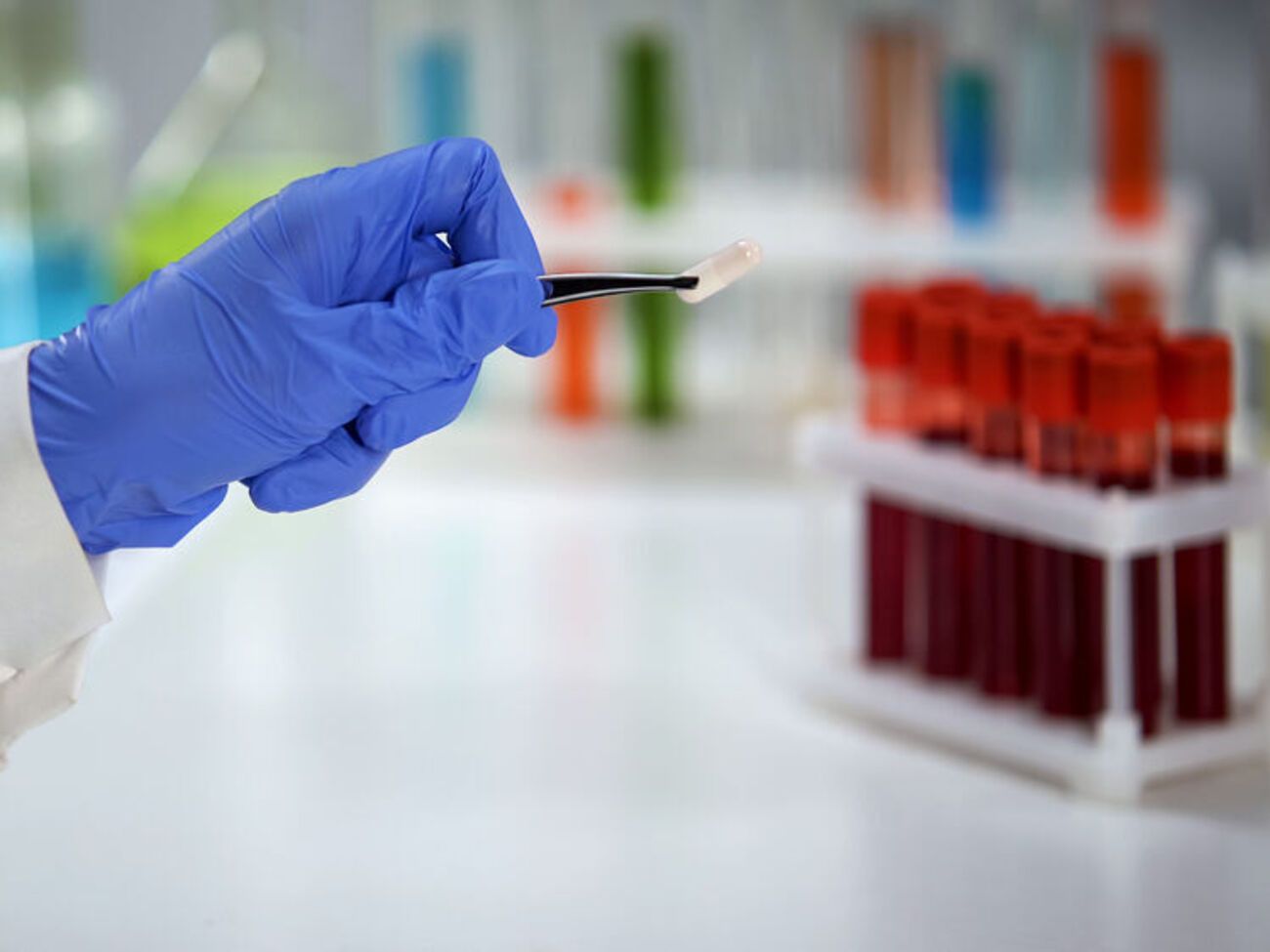 В прошлом году 2,5 млн украинцев прошли тестирование на ВИЧ-инфекцию