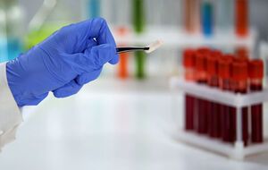 В прошлом году 2,5 млн украинцев прошли тестирование на ВИЧ-инфекцию