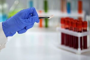 Торік 2,5 млн українців протестувалися на ВІЛ-інфекцію