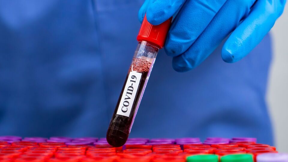 Штам коронавірусу "Омікрон" виявили у 110 країнах