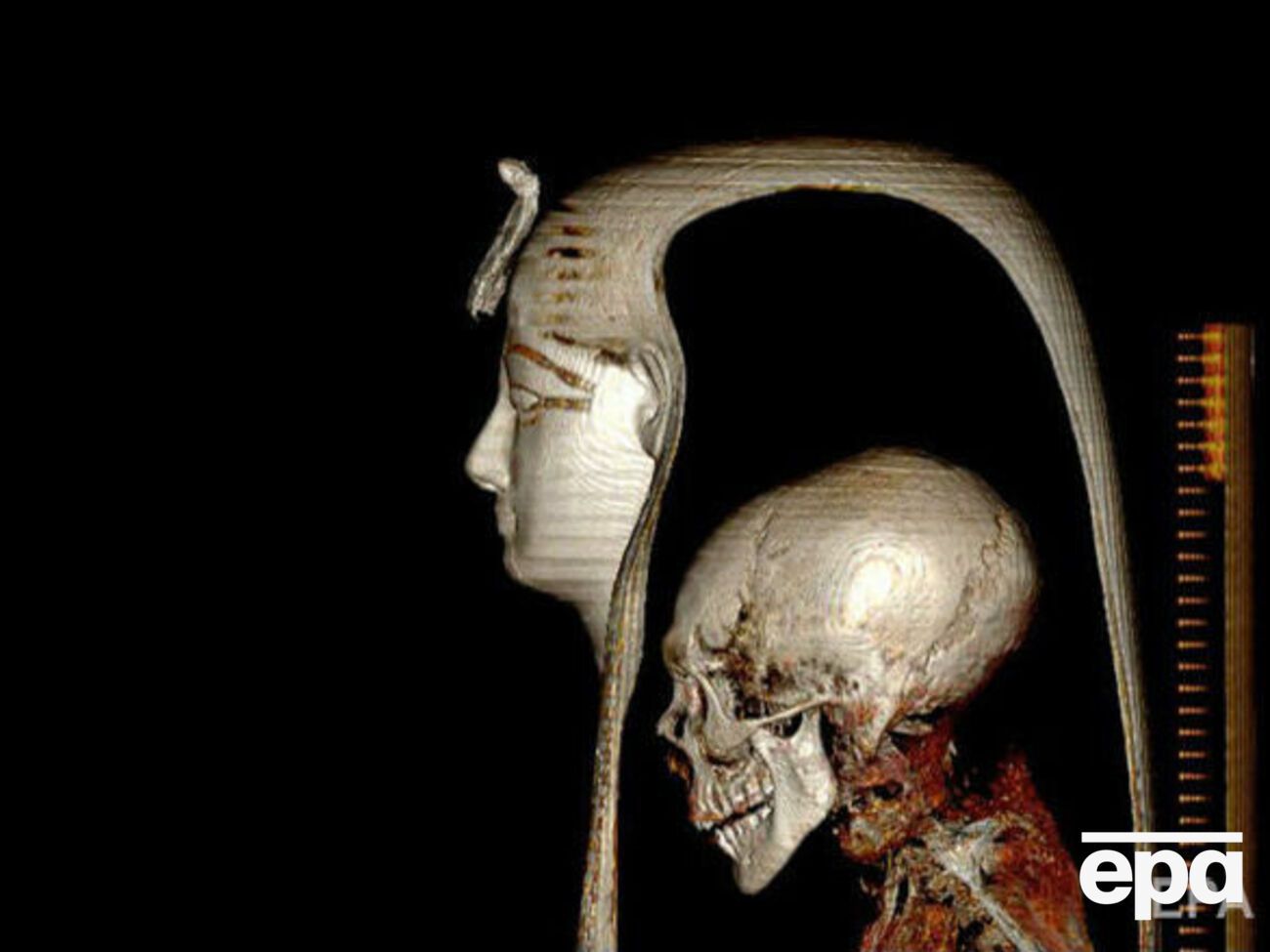 На момент смерті фараону було приблизно 35 років