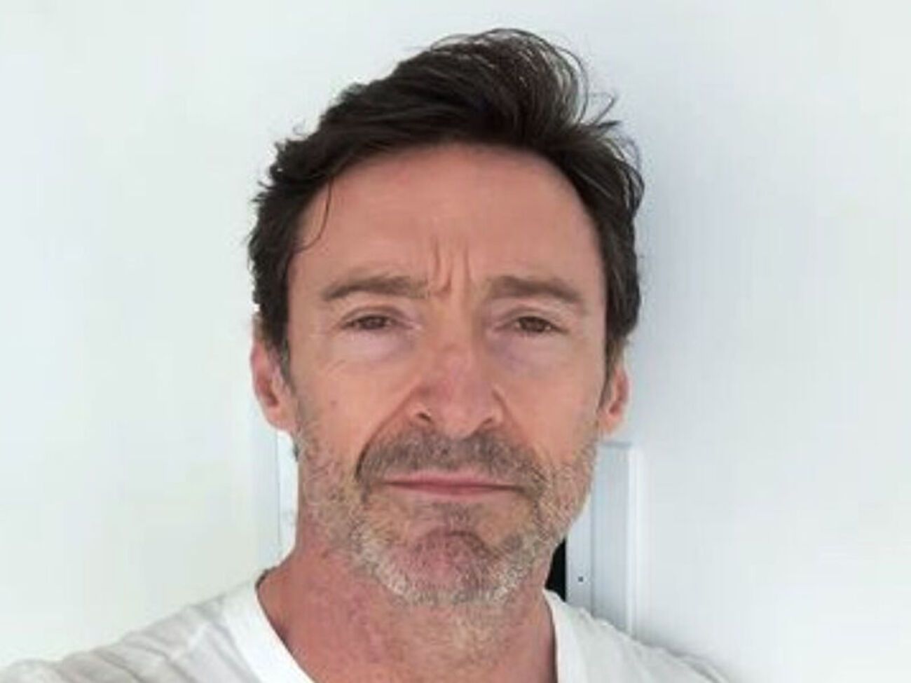 По словам Джекмана, болезнь протекает у него в легкой форме