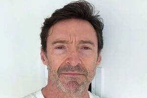 По словам Джекмана, болезнь протекает у него в легкой форме