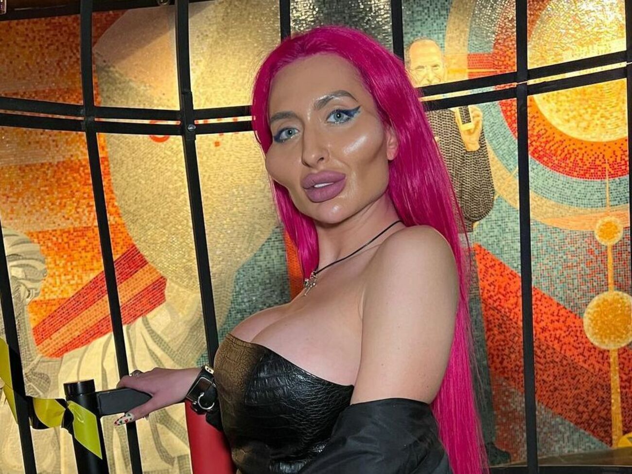 За три года многочисленных хирургических вмешательств Анастасия Покрещук изменилась до неузнаваемости