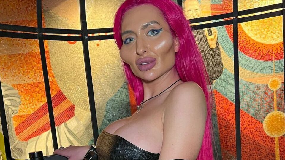 За три года многочисленных хирургических вмешательств Анастасия Покрещук изменилась до неузнаваемости