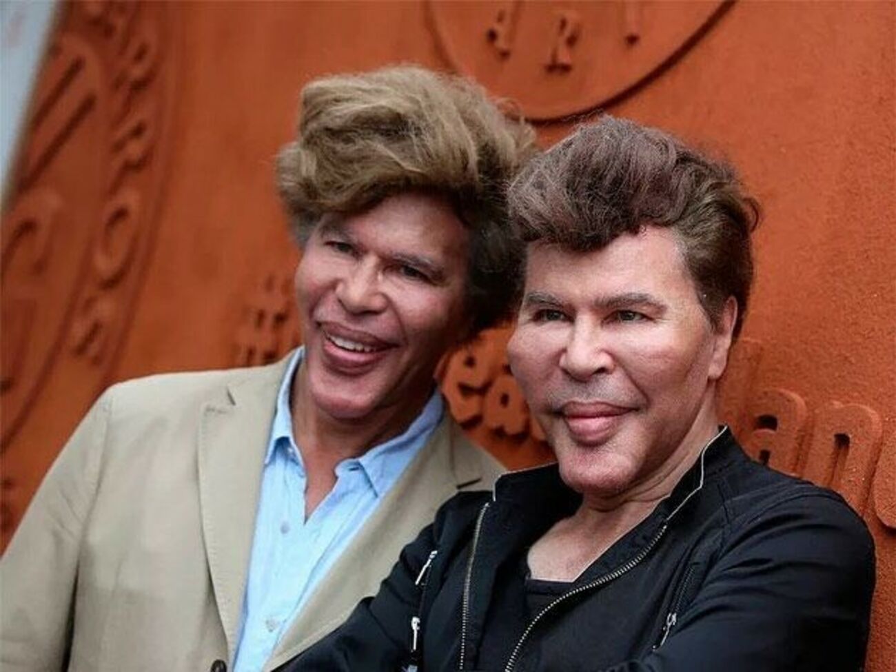 Григорій Богданов (праворуч) та Ігор Богданов (ліворуч) заперечували факт втручання пластичної хірургії у свою зовнішність