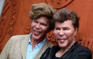 Григорий Богданов (слева) и Игорь Богданов (справа) отрицали факт вмешательства пластической хирургии в свою внешность