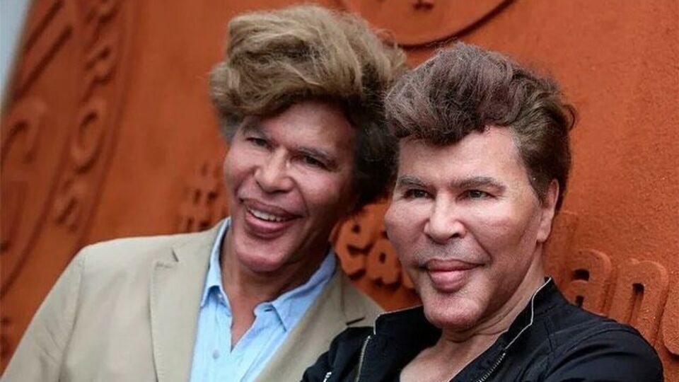 Григорий Богданов (слева) и Игорь Богданов (справа) отрицали факт вмешательства пластической хирургии в свою внешность