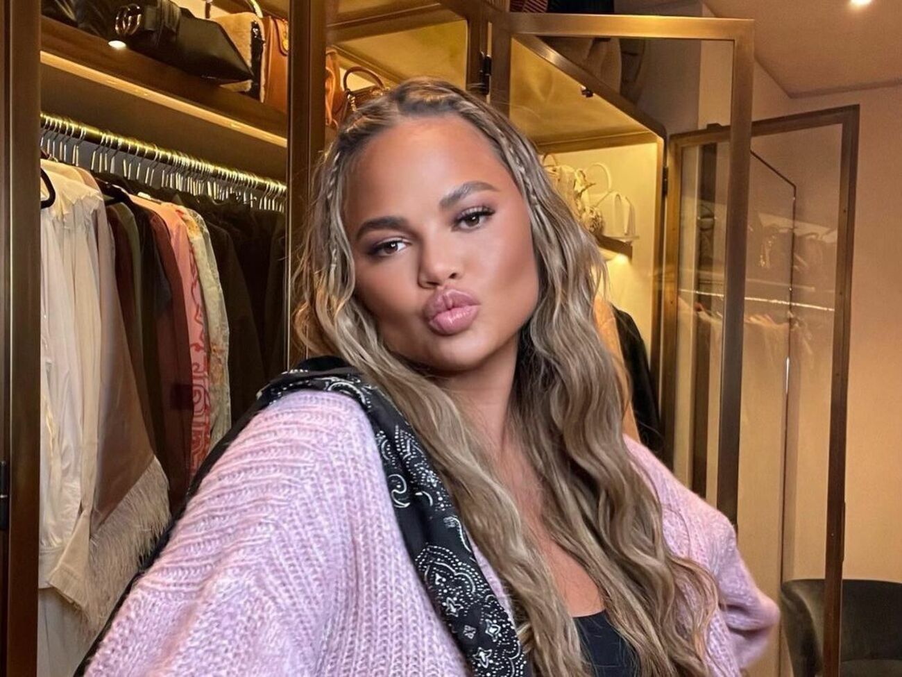 В ноябре 2021 года Крисси Тейген сделали операцию по пересадке бровей