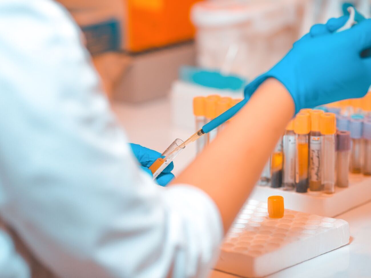 В Україні від початку епідемії підтвердили понад 3,66 млн випадків COVID-19