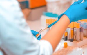 В Украине с начала эпидемии подтвердили более 3,66 млн случаев COVID-19