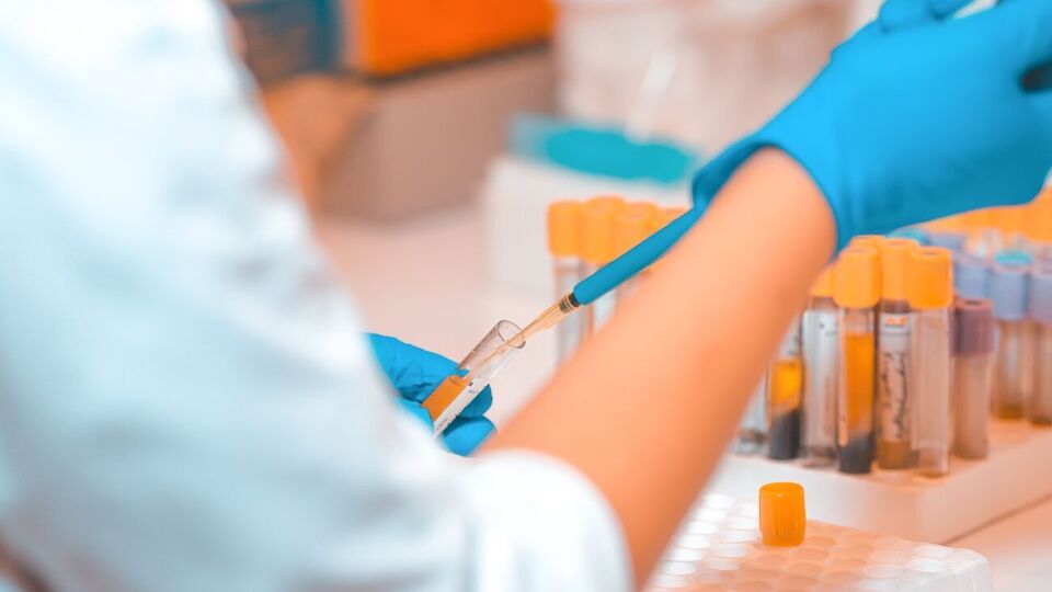 В Україні від початку епідемії підтвердили понад 3,66 млн випадків COVID-19