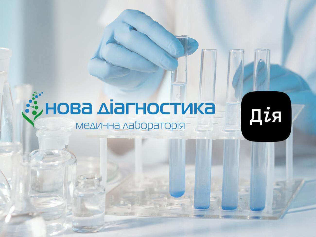 Відділення лабораторії "Нова діагностика" працюють цілодобово