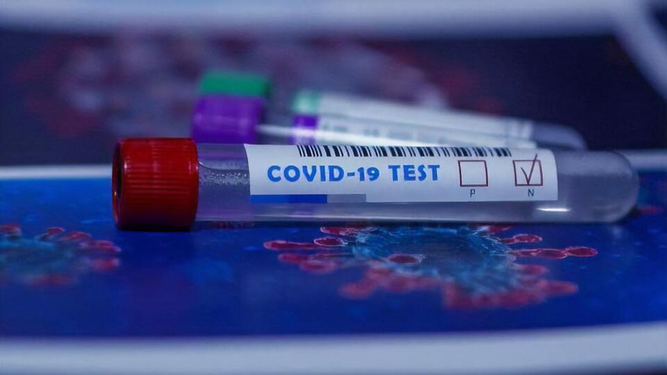 Кількість випадків COVID-19 перевищує в Україні 1,2 млн