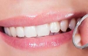 Каждому полезно разобраться, из чего делают современные пломбы