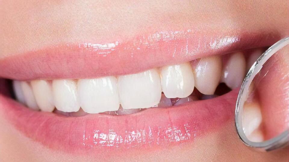 Каждому полезно разобраться, из чего делают современные пломбы