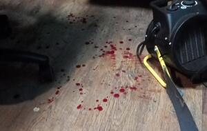 По словам Воротника, его били вдвоем, напав сзади