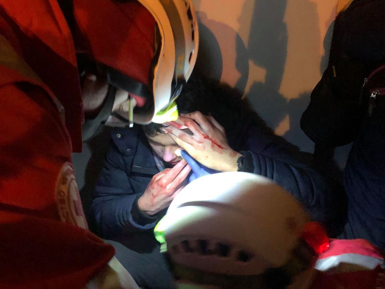 Під час сутичок із правоохоронцями під ОПУ постраждало кілька людей