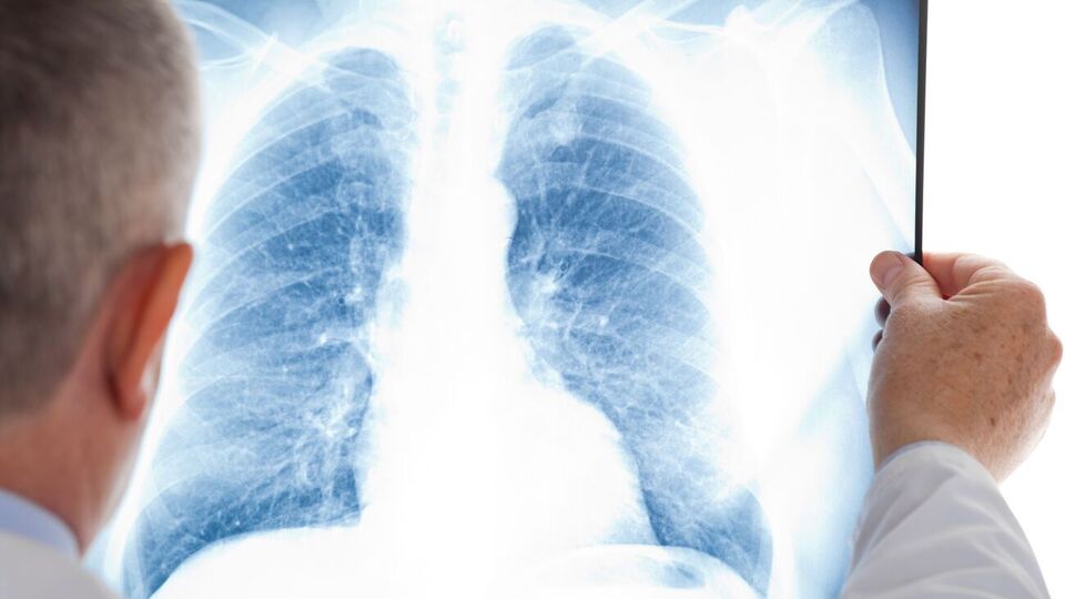 Женщина умерла после трансплантации легких