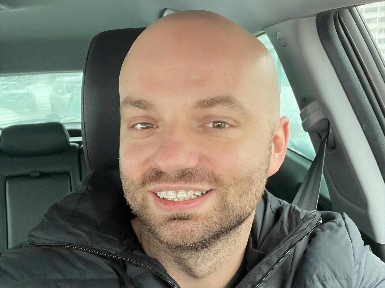 Дьомін: Є&nbsp;відчуття, ніби язик став не поміщатися в рот і почав тертися об зуби