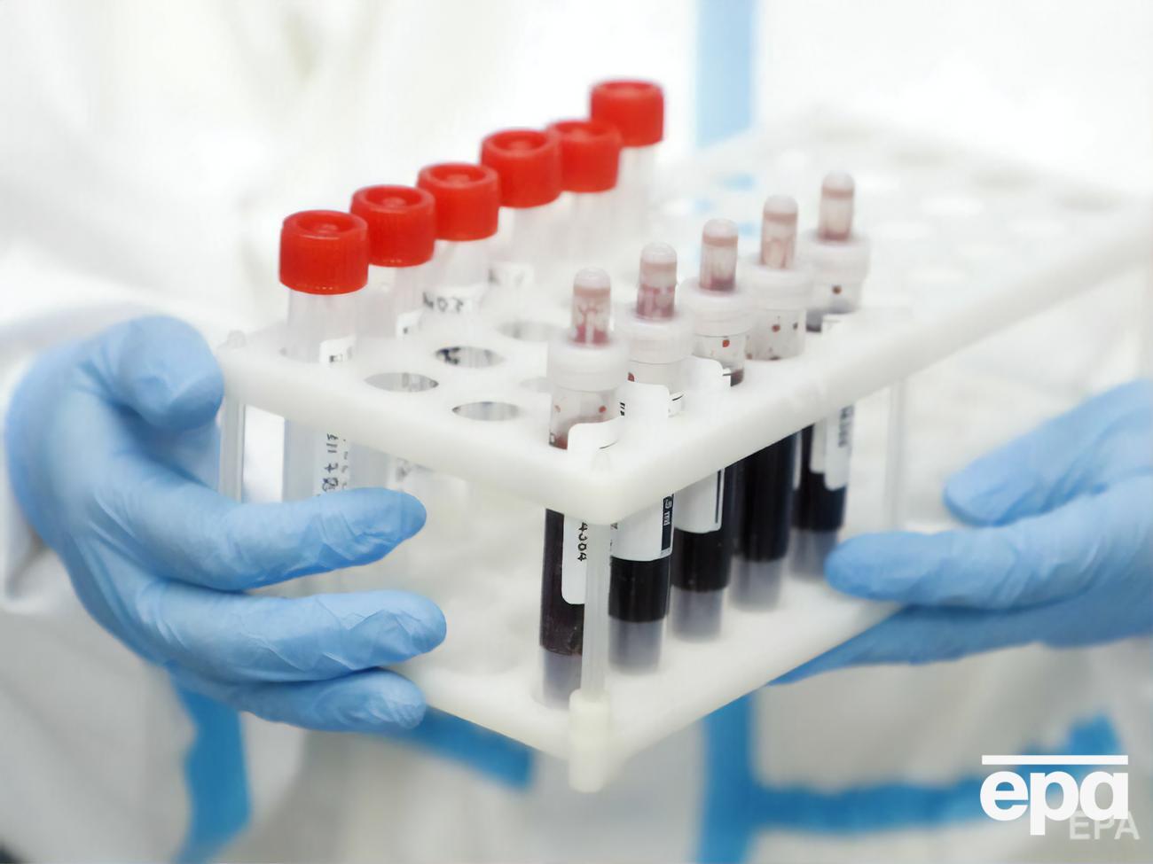 Мутации коронавируса были выявлены в&nbsp;16 случаях