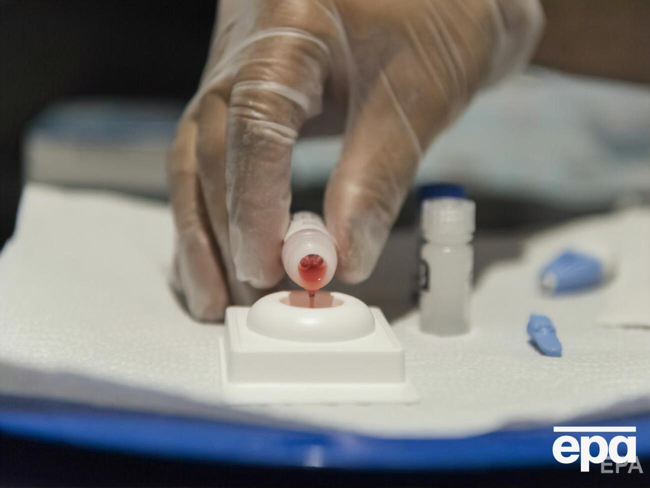 Мужчину лечили стволовыми клетками