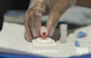 Мужчину лечили стволовыми клетками