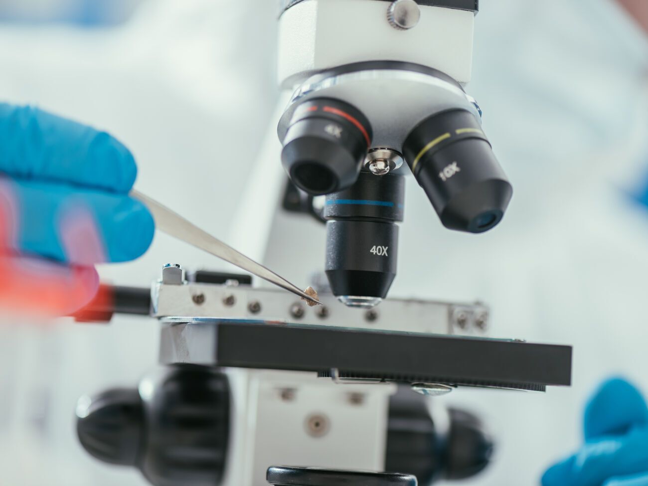 В Україні від початку епідемії підтвердили майже 1,6 млн випадків коронавірусної інфекції