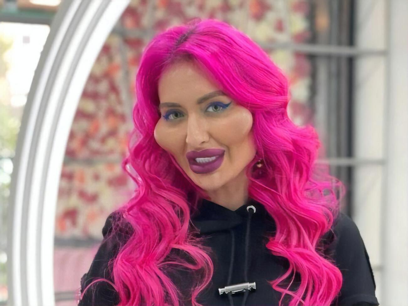 Покрещук получила всемирную известность после того, как с помощью инъекций увеличила скулы