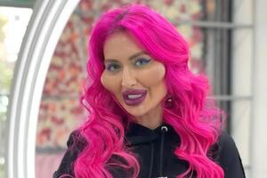 Покрещук получила всемирную известность после того, как с помощью инъекций увеличила скулы