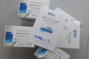 "Еквітестлаб" випускає тест-системи для діагностики COVID-19