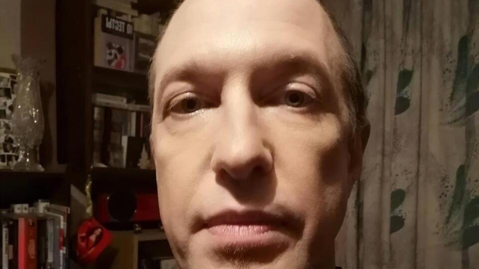 Соседов: Операция прошла успешно. Было не больно, потому что сделали анестезию. Но, конечно, неприятно