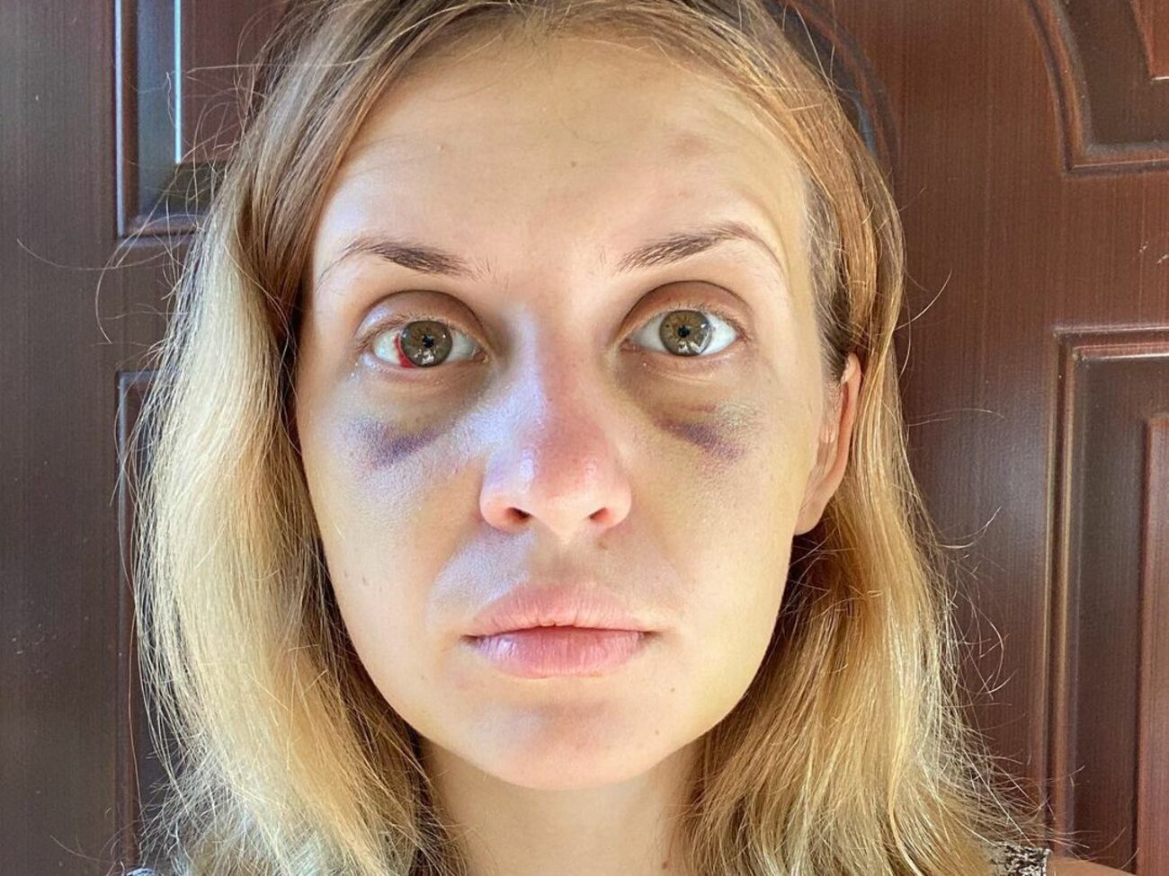 Лугову влітку 2020 року побив Рудзько на очах у її сина