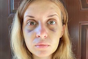 Лугову влітку 2020 року побив Рудзько на очах у її сина