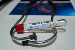 Важным моментом пандемии Жиравецкий считает тестирование