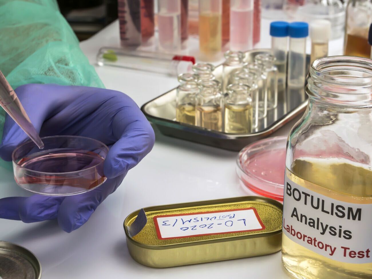 Специалисты проводят лабораторные исследования для подтверждения заболевания ботулизмом трех человек