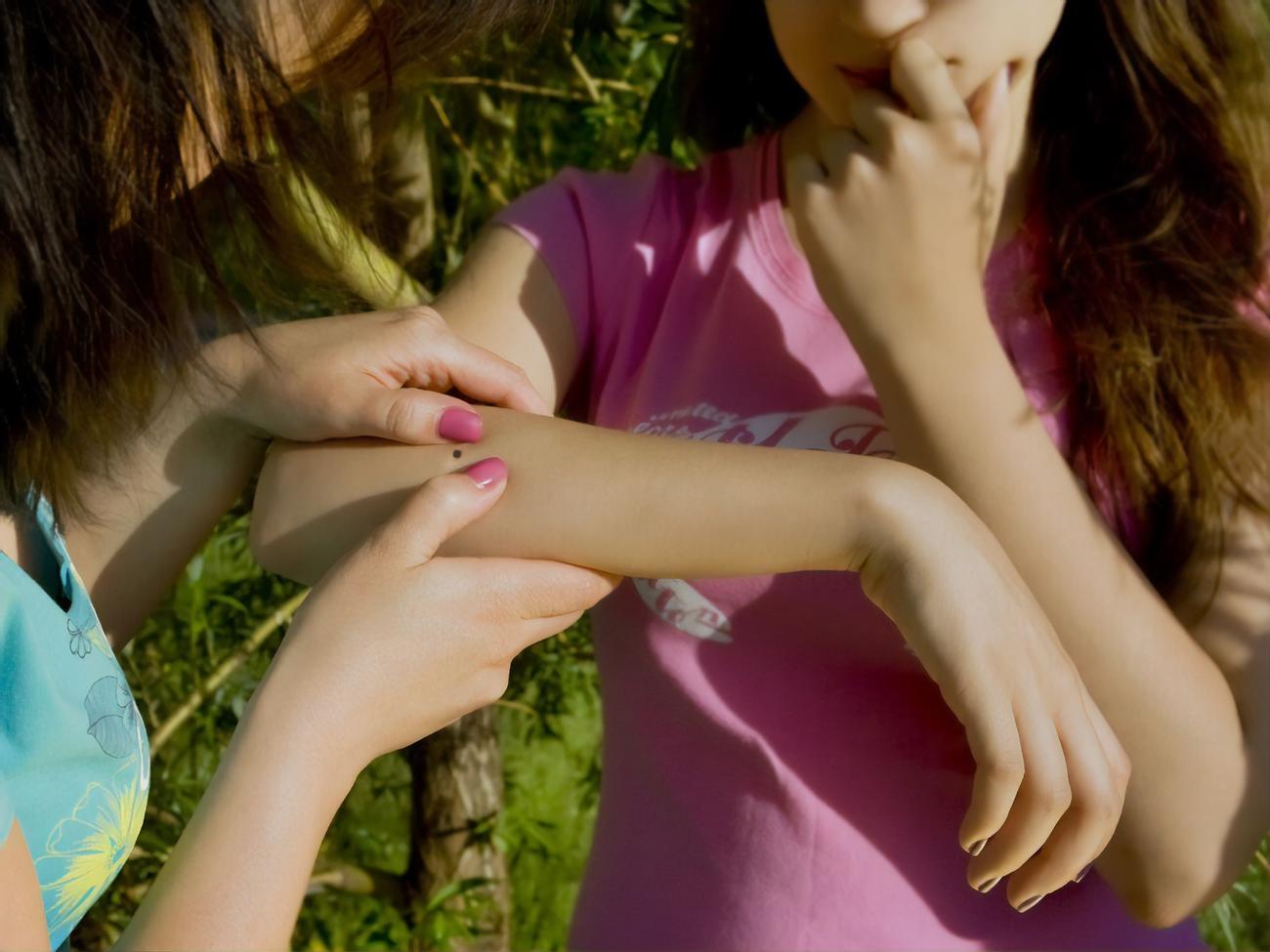 Отдыхая на природе, нужно внимательно осматривать свое тело на предмет обнаружения клеща