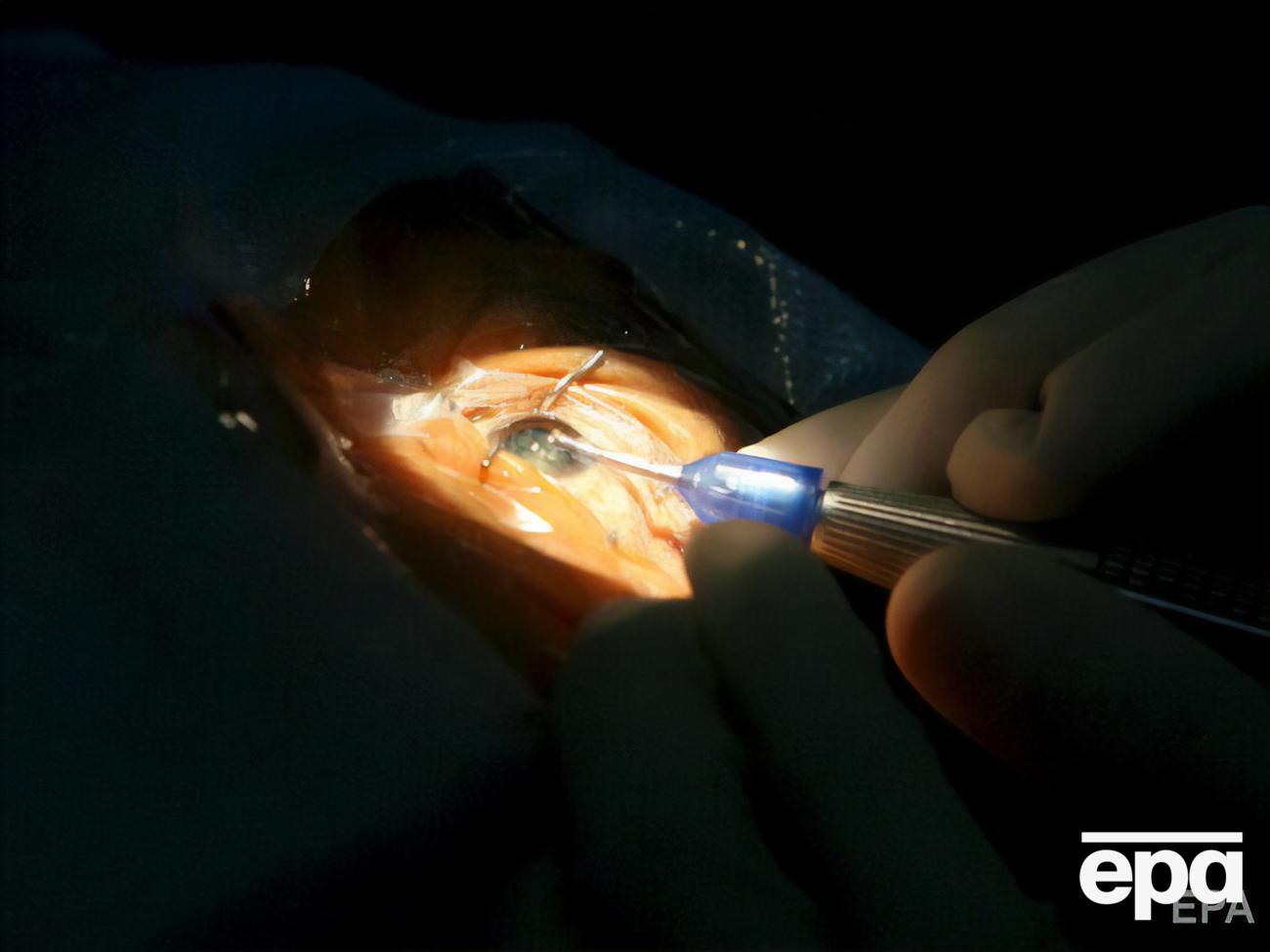 Специалисты не надеются на полное восстановление зрения у пациента