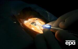 Специалисты не надеются на полное восстановление зрения у пациента