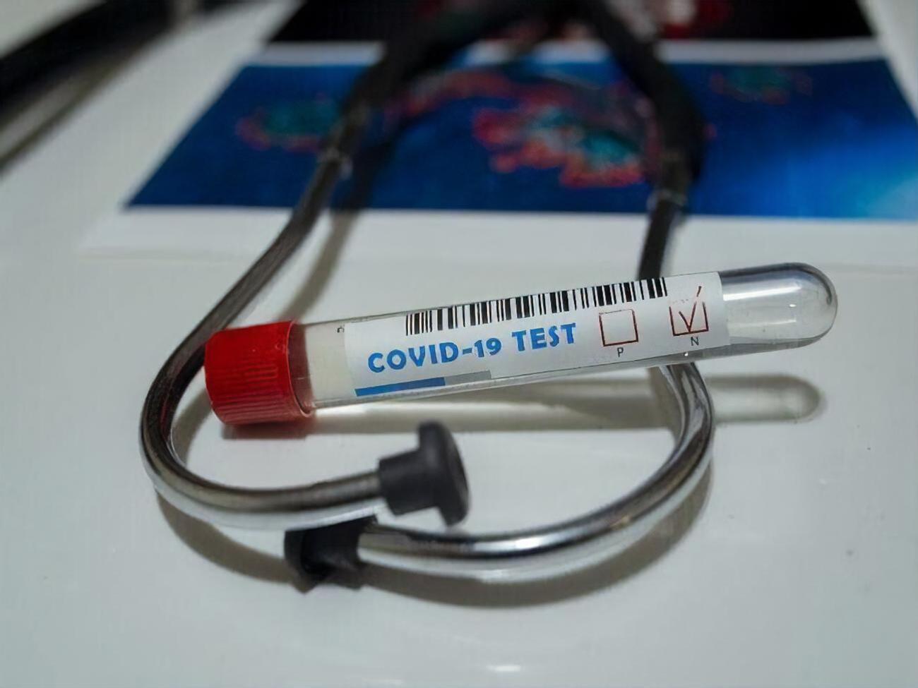 В Украине подтвердили почти 2,2 млн случаев COVID-19