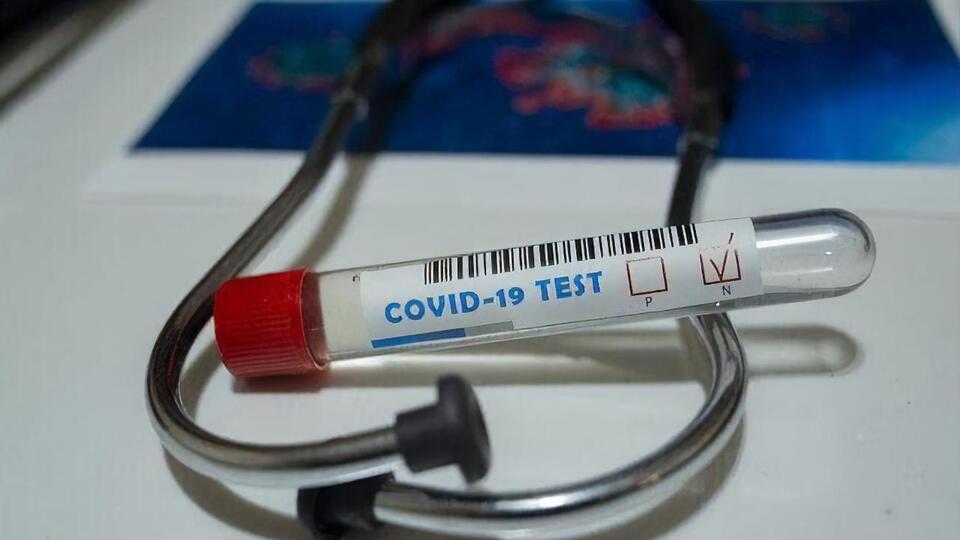 В Украине подтвердили почти 2,2 млн случаев COVID-19