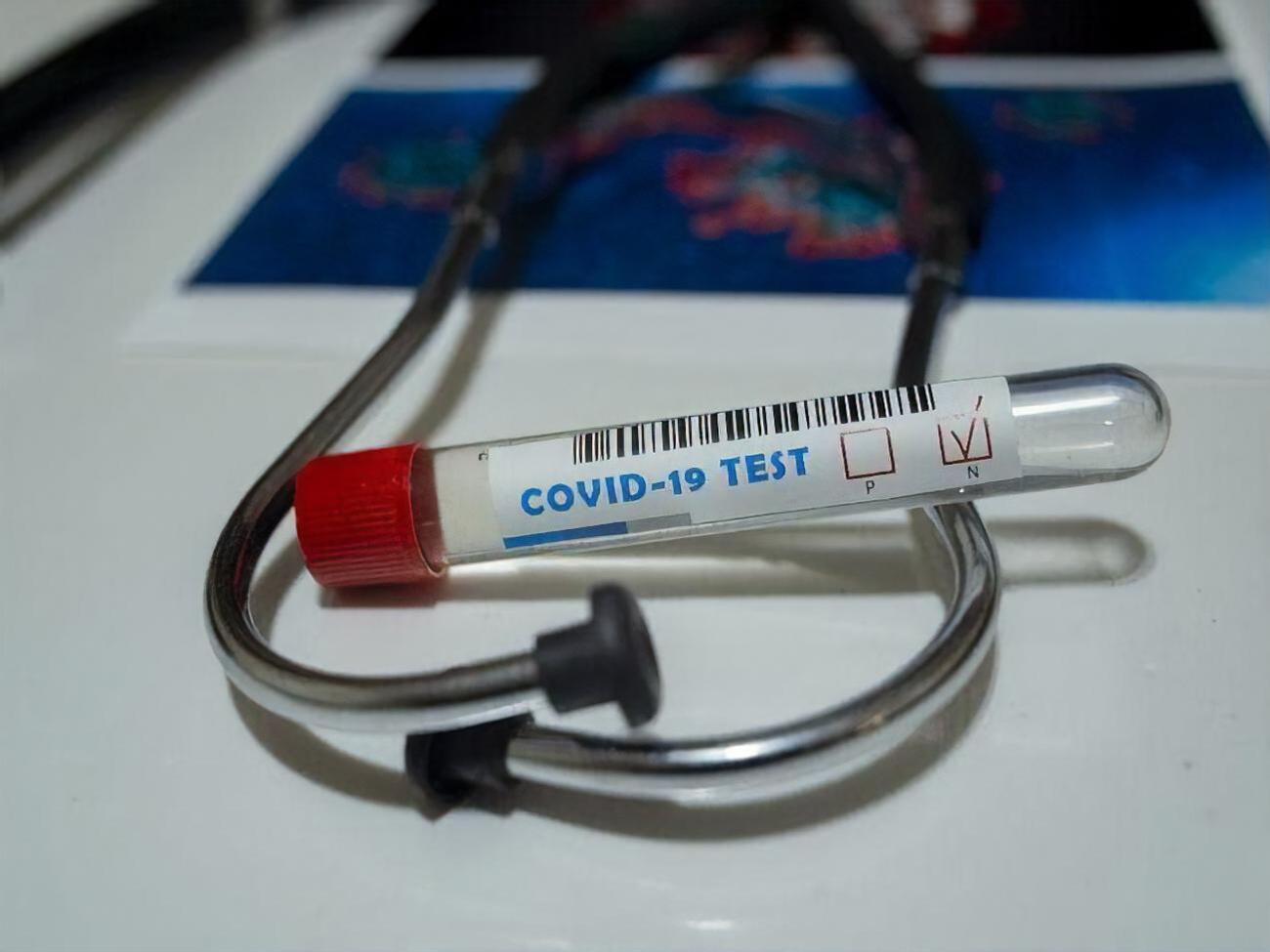 Епідеміолог стверджує, що на регіони "тиснуть" у зв'язку зі статистикою виявлення COVID-19