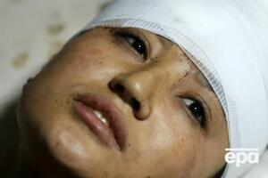 Ранения в результате взрыва получили более 50 человек (на снимке – одна из школьниц, пострадавших в ходе теракта)