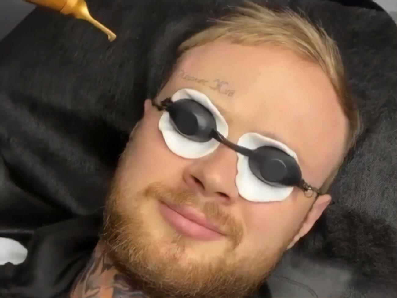 С надписью на лбу харьковчанин ходил с конца 2020 года